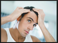 Cách làm mọc tóc vùng trán hiệu quả tốt nhất