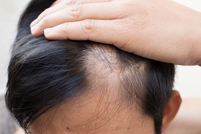 Hơn 100 ảnh về cách làm tóc mềm cho nam 