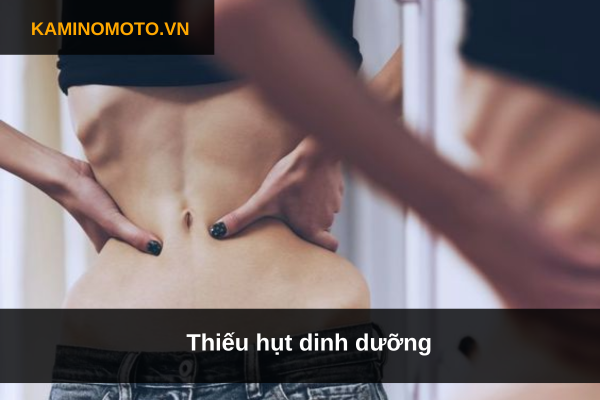 Thiếu hụt dinh dưỡng