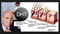 Dihydrotestosterone là gì? DHT là gì?