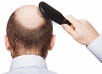 Cách giúp tóc mọc nhiều và nhanh cho nam giới